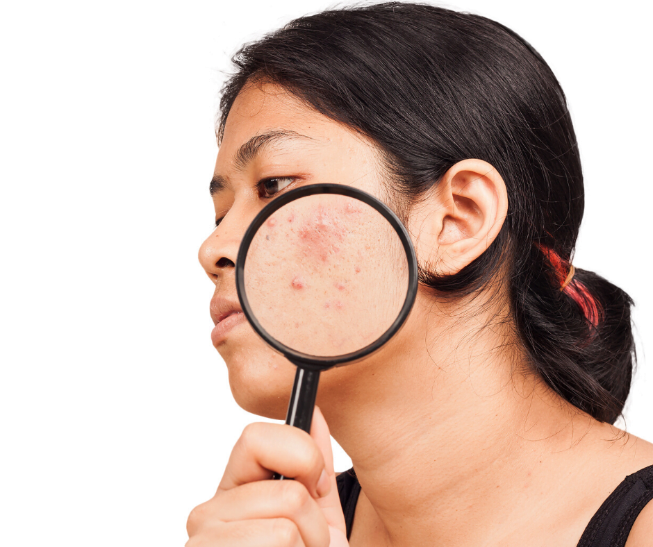 When you lack fibre, you are more likely.