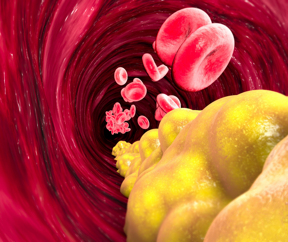 Cholesterol is also needed by the body, but it can be dangerous in large amounts.