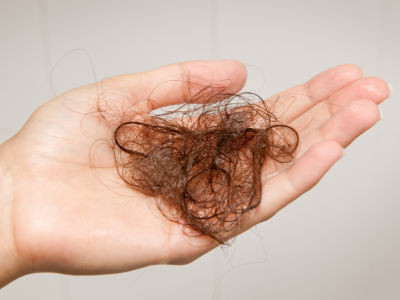 Hand holding a clump of fallen hair after shedding