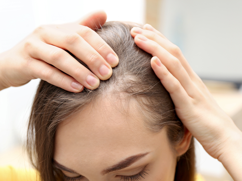 Woman checking thinning hair by parting scalp with both hands