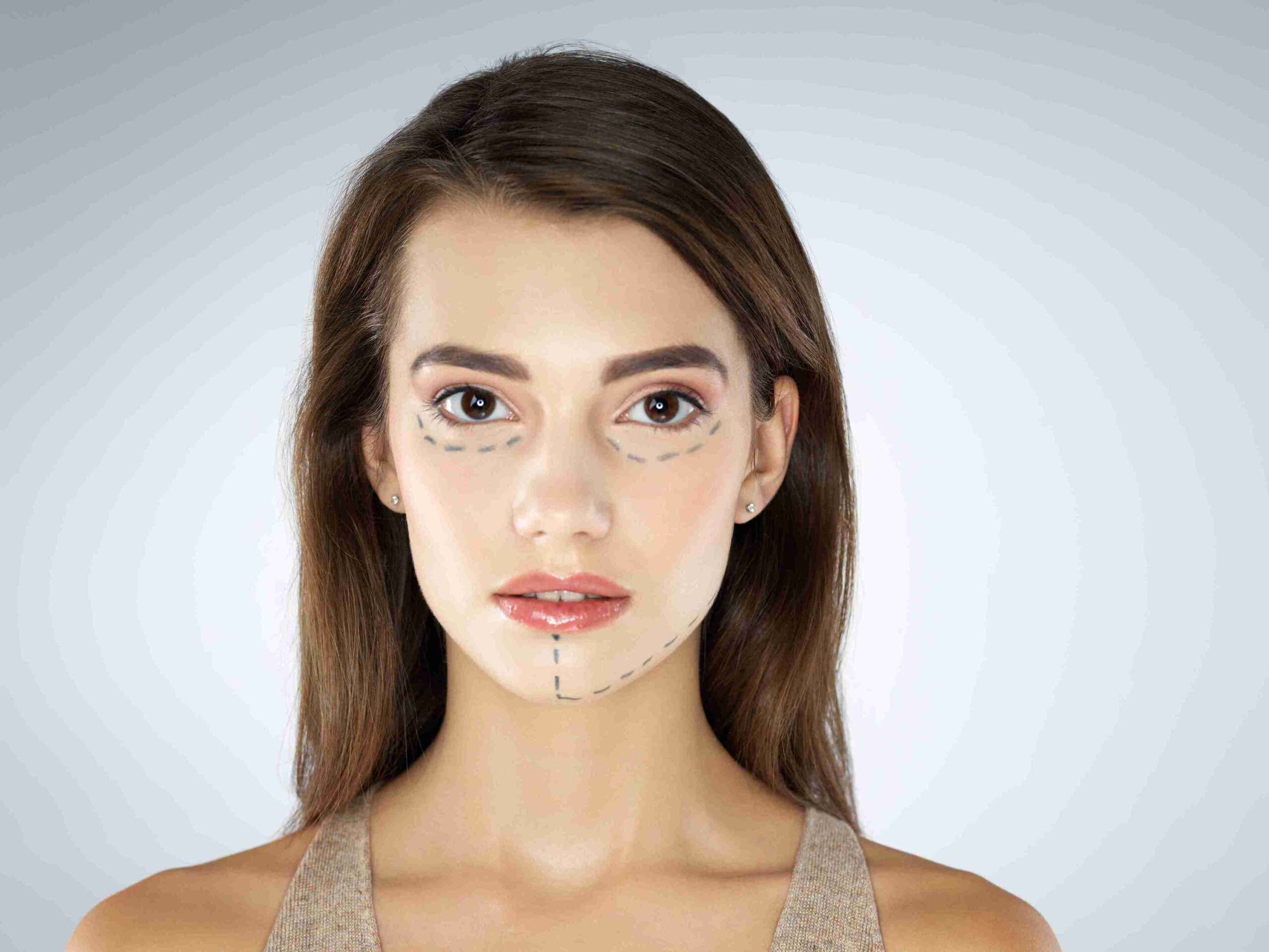 woman with marks on her face for surgery