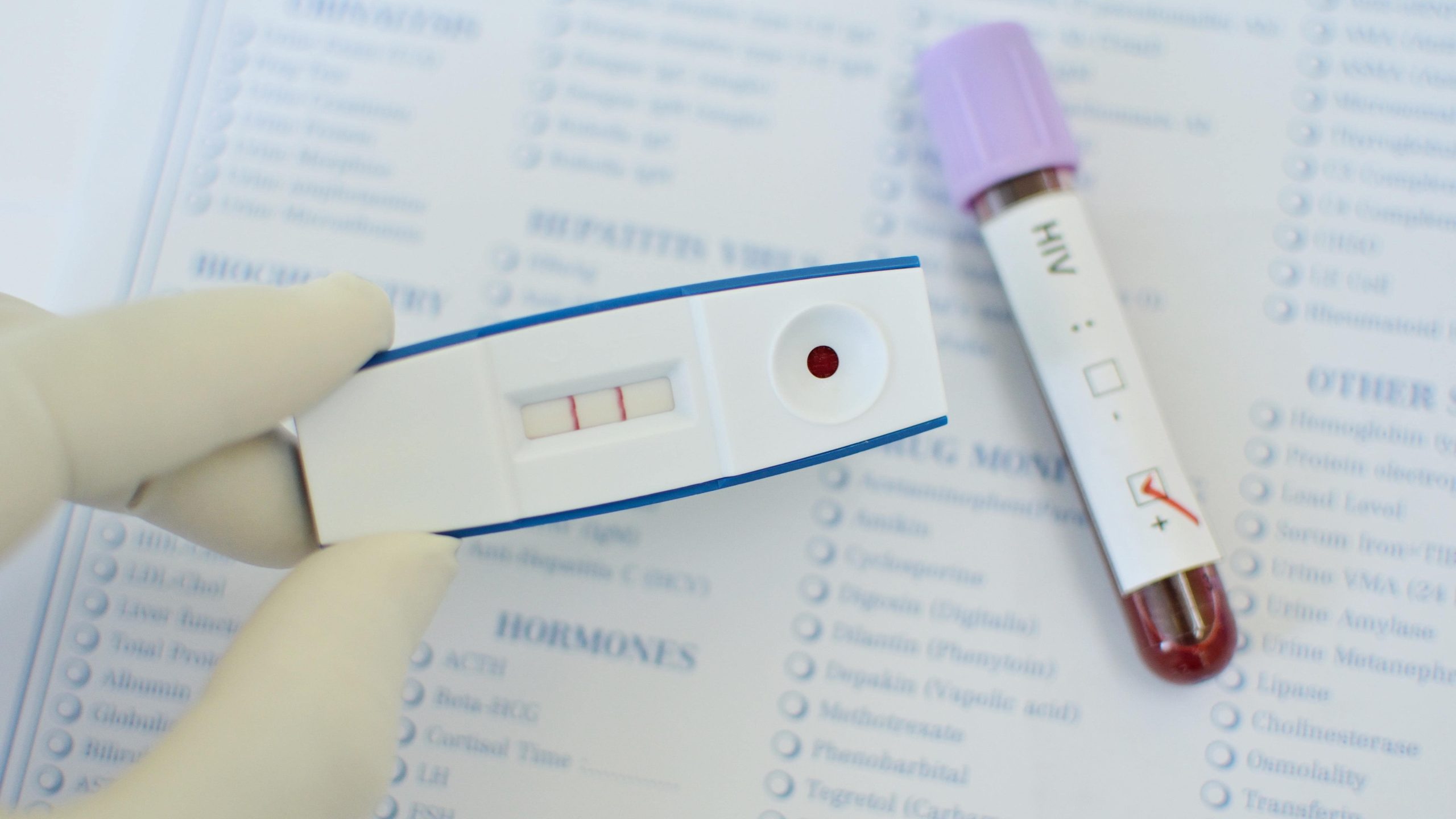 test kit with positive result for HIV